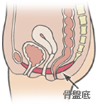 出産や老化による「骨盤底の筋肉や靱帯」のゆるみ