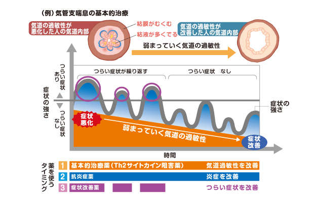 気管支喘息の基本的治療