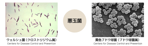 悪玉菌：ウェルシュ菌（クロストリジウム属）黄色ブドウ球菌（ブドウ球菌属）