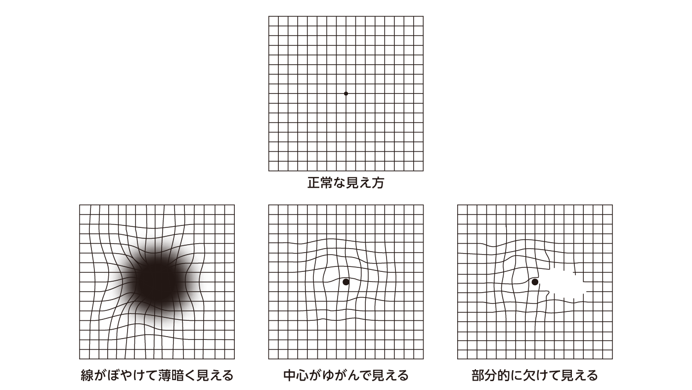 見え方のイメージ