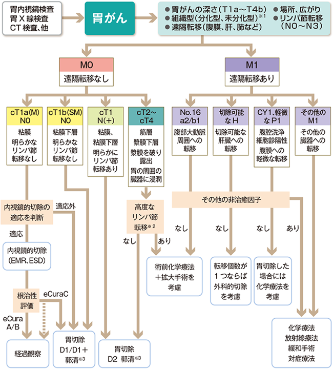 胃がんの治療法の説明図