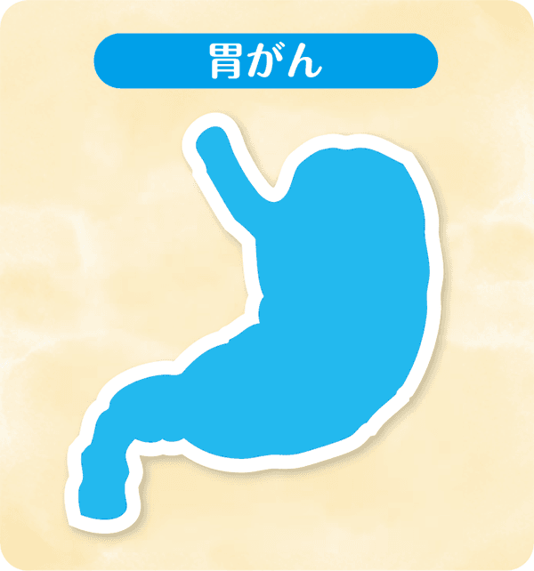 胃がん