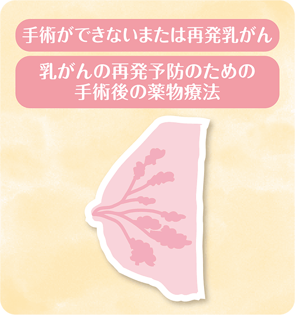 手術ができないまたは再発乳がん 乳がんの再発予防のための手術後の薬物療法